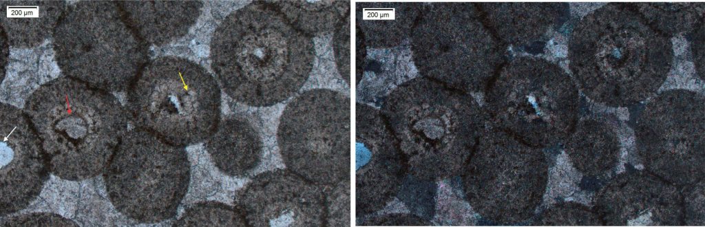 Aggrading neomorphism in these ooids has overprinted most of the original concentric and radial fabrics. Neomorphism is most advanced in the cores of each ooid. Maximum crystal size is 60-80 μm in ooid cores (yellow arrow), becoming finer towards the outer rims. The outer rim of each ooid has a fuzzy appearance due to recrystallization of the outer carbonate layer and the intergranular calcite cement. Several ooids have grown around fine sand-sized quartz grains (white arrow) or lime mud grains (red arrow). Left: Plain polarized light. Right: Crossed polars.